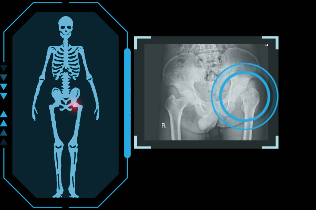 Radiographie articulaire